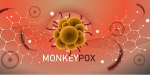 Monkeypox